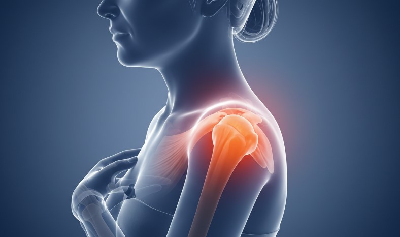 Painful inflammation of the shoulder joint